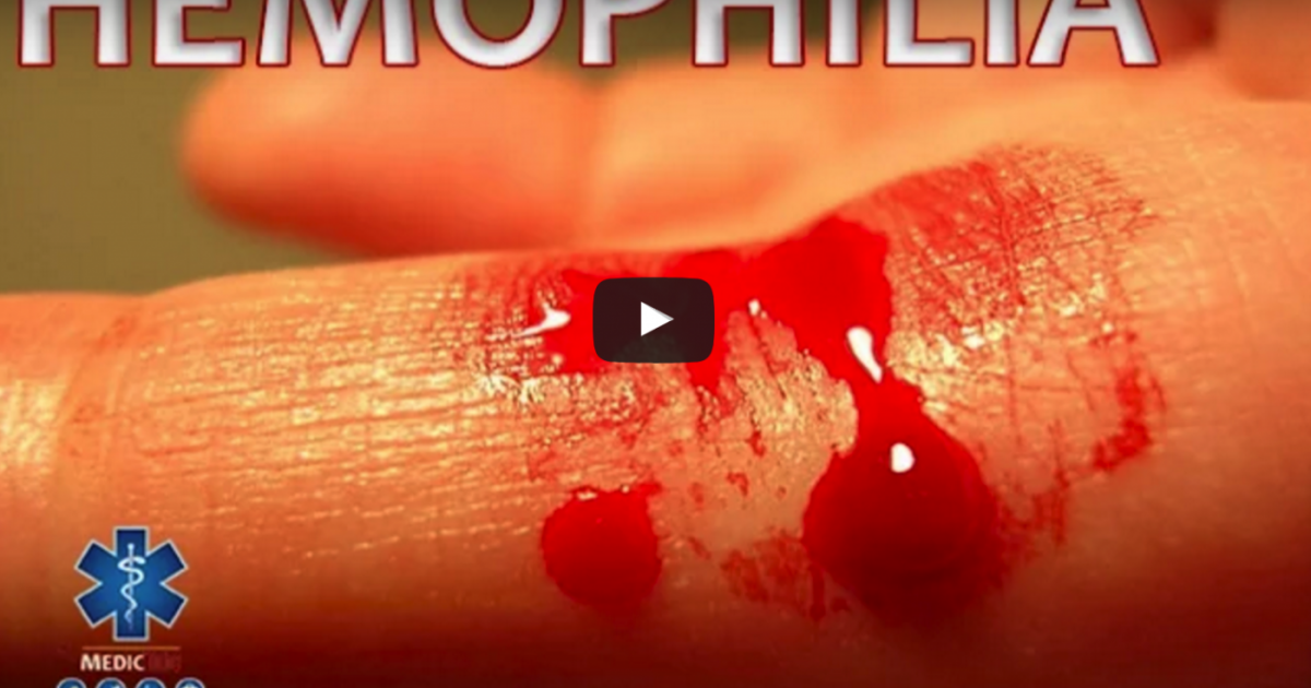 Explaining Joint Bleeding in Hemophilia Hemophilia News Today