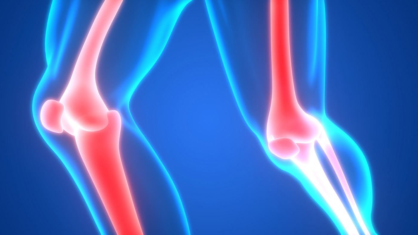 Hemophilia without prophylaxis: Assessment of joint range of