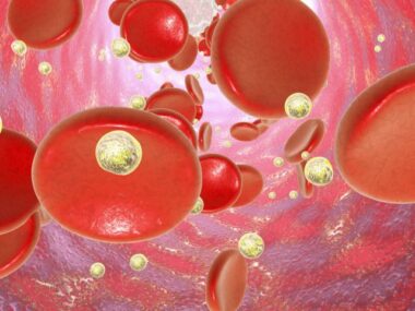 acquired hemophilia A study