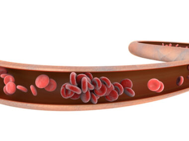 Highmark hemophilia partnership