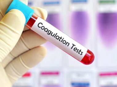 Enzypad and monitoring