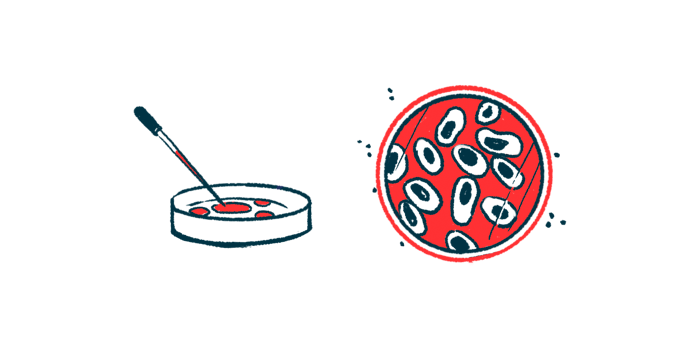 umbilical stems cells | Hemophilia News Today | FVIII replacement therapy | illustration of petri dish