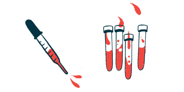 ITI | Hemophilia News Today | hemophilia A | illustration of test tubes and syringe with blood