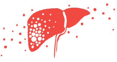 hemophilia A gene therapy | Hemophilia News Today | illustration of liver