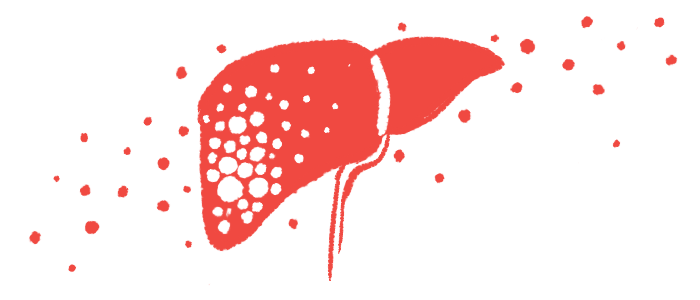 hemophilia A gene therapy | Hemophilia News Today | illustration of liver