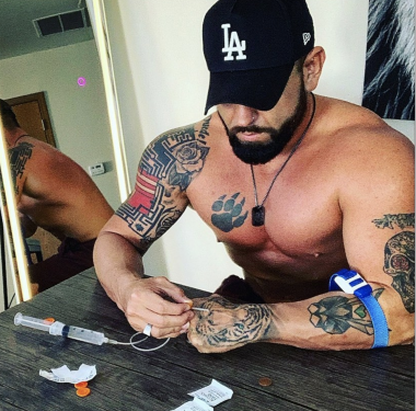 bodybuilder | Hemophilia News Today | a photo of L.A. with his shirt off, giving himself an infusion
