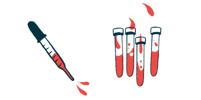 An illustration shows several test tubes and a syringe with serum in them.