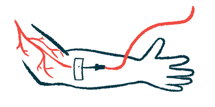 Illustration of a person receiving an intravenous infusion in the arm.