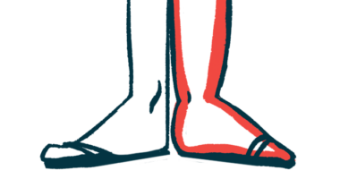 An illustration of person's lower legs and ankles.
