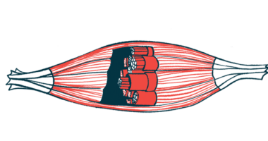 Illustration of the inside of a muscle.