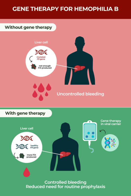 Gene therapy for hemophilia B