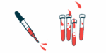A dropper squirting blood is seen alongside four half-filled vials.