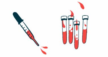 A dropper squirting blood is seen alongside four half-filled vials.