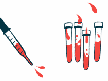 A dropper squirting blood is seen alongside four half-filled vials.