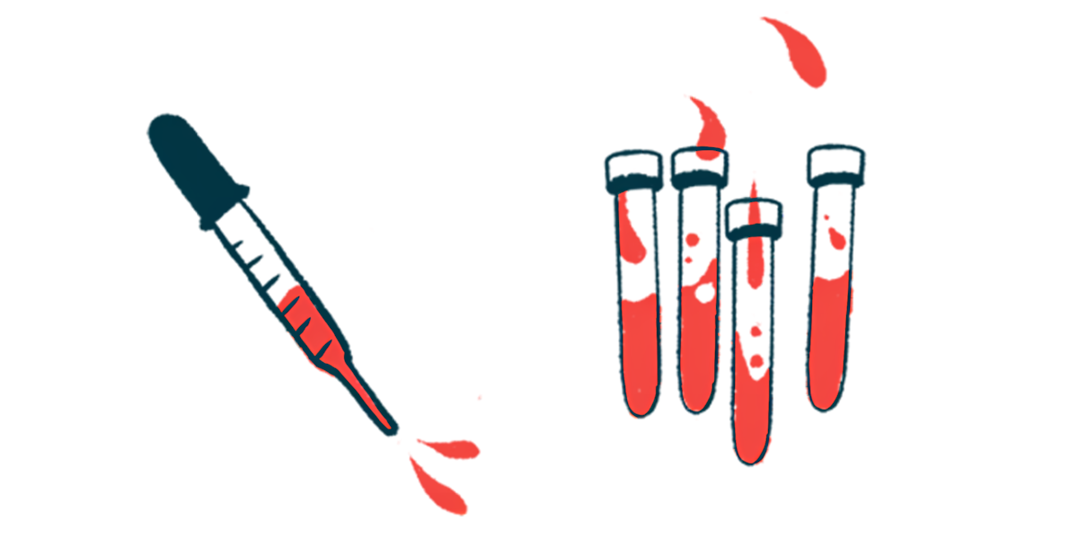 A dropper squirting blood is seen alongside four half-filled vials.