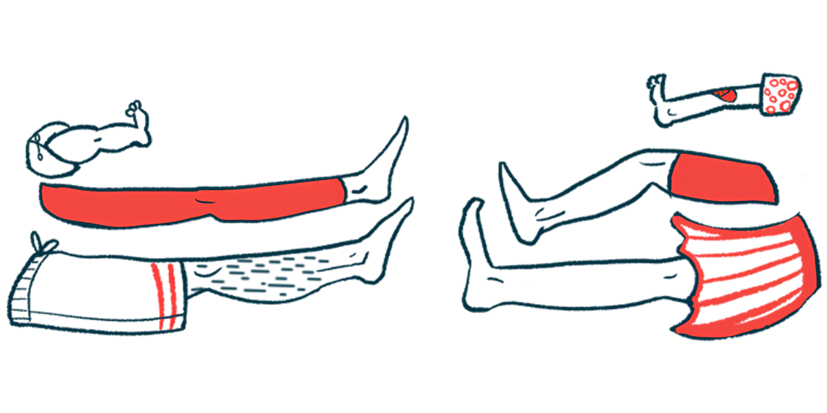 This illustration shows six legs, ranging from an infant's to those children and adults.
