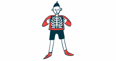 A person holds an X-ray image of his chest.