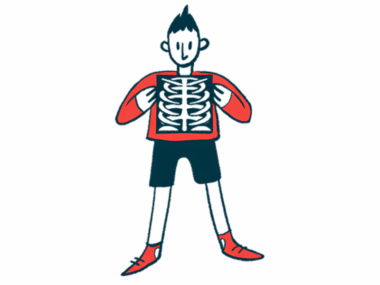 A person holds an X-ray image of his chest.