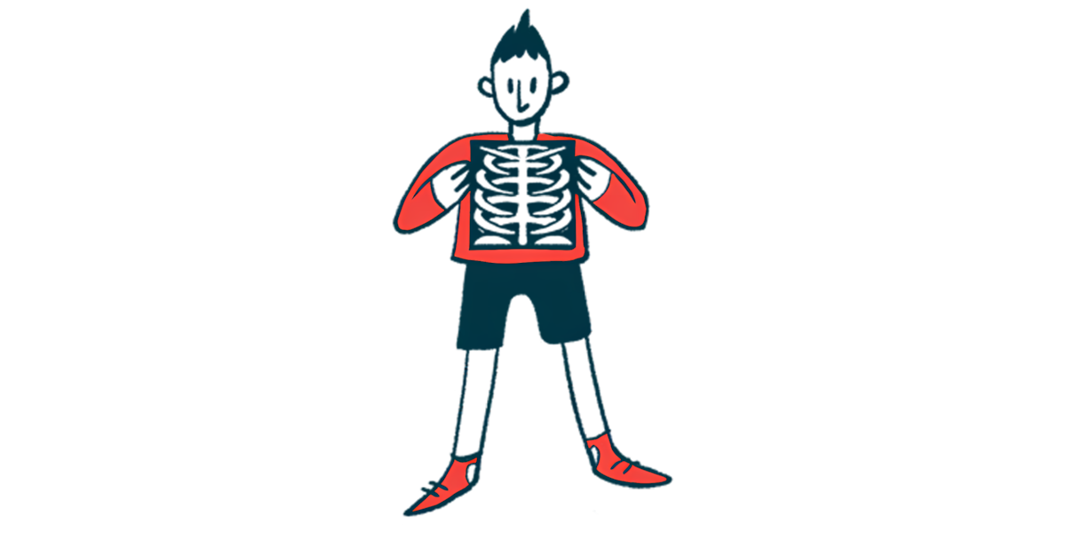 A person holds an X-ray image of his chest.